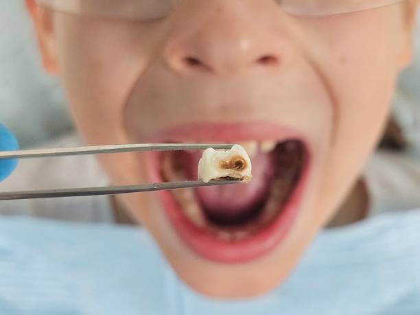 Best Pediatric Emergency Dentist in Belding, MI